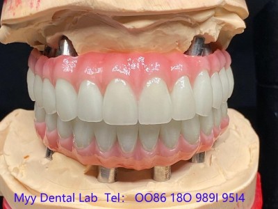 加拿大义齿加工厂,义齿公司,假牙加工厂