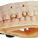 假牙 义齿 外贸